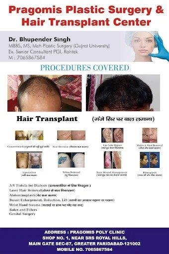 Best Hair Transplant Doctor Center in Faridabad