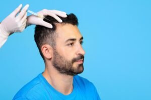Best Hair Transplant Surgery Doctor in Faridabad