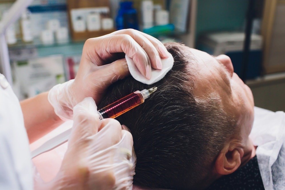 Best Hair Transplant Doctor in Faridabad
