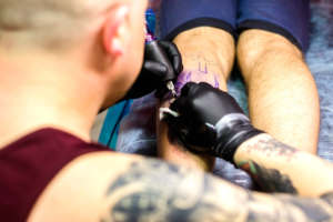 Best Tattoo Removal clinic in Faridabad