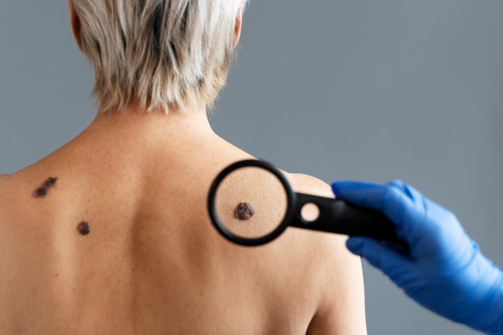 best scar revision treatment in Sector 29, Faridabad