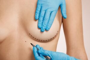 Breast Augmentation and Reduction in Sector 27/A