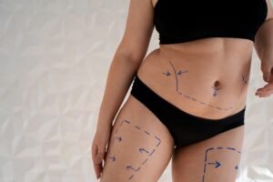 Best Tummy Tuck Treatment in Sector 29