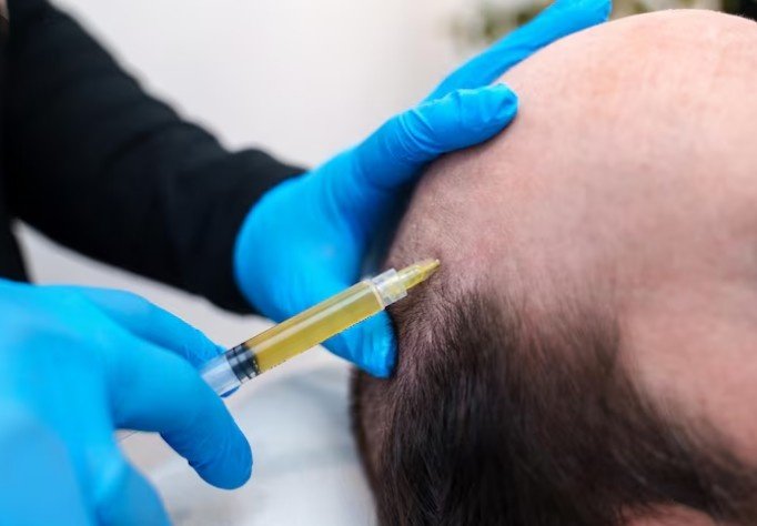 Best PRP for Hair Transplant in Sector 29, Faridabad