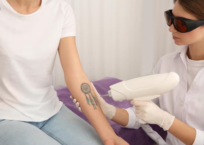 Best Laser Technology for Tattoo Removal in Faridabad