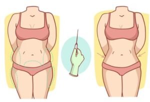 Best Tummy Tuck Surgeon in Sector 28, Faridabad