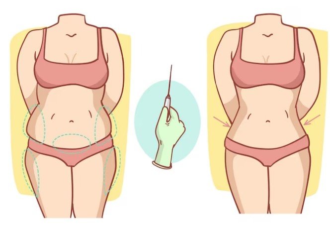 Best Tummy Tuck Surgeon in Sector 28, Faridabad