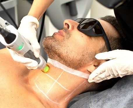 Best Hair Reduction Center in Sector 29, Faridabad